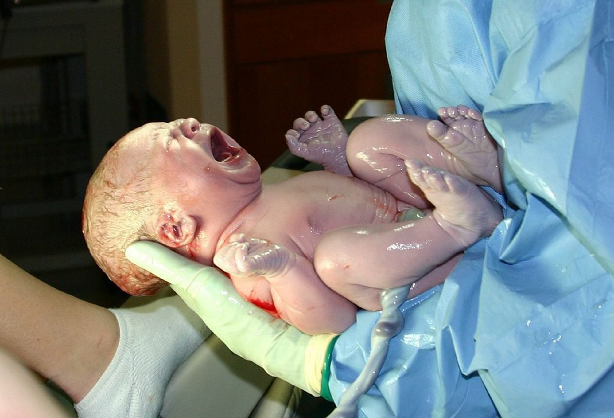 ارث بردن نوزاد به یک نفس بند است